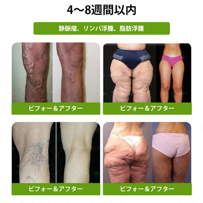 【完全新改良パッチ PLUS】🌙🌙𝑳𝒖𝒙𝒂𝒓𝒊𝒔𝒆® モリンガ＆ベルベリン 10-IN-1 高機能ナノマイクロニードルパッチ（1日1回、7日で変化を実感）✅肥満・糖尿病・睡眠時無呼吸症候群・関節の悩み向け